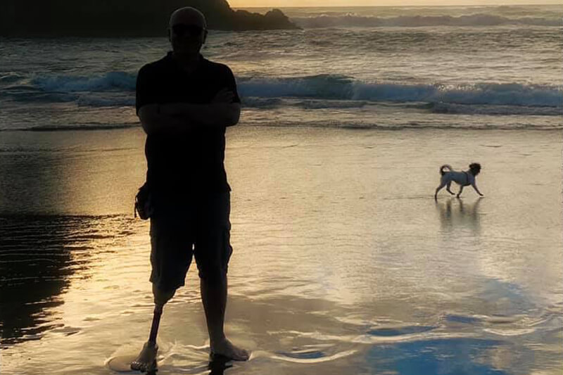 peer support for amputees